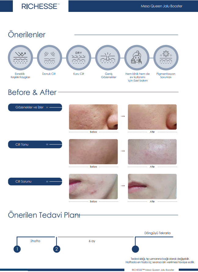 RICHESSE Meso Queen detay